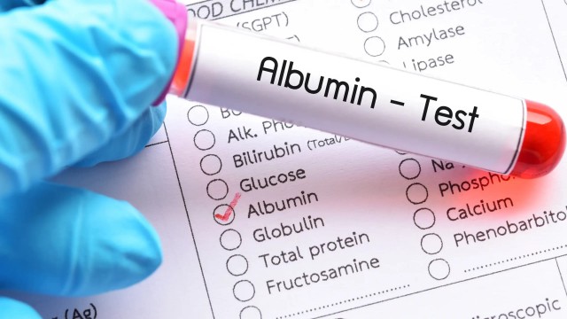 Định lượng Albumin và quy trình xét nghiệm định lượng Albumin