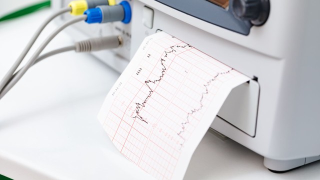 Đo cơn gò tử cung​ bằng máy monitor có ý nghĩa gì?