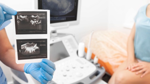 Độ mờ da gáy 1.0mm có bình thường không? Ý nghĩa và những điều mẹ bầu cần biết