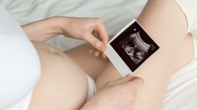 Độ mờ da gáy cao nhưng NIPT bình thường có nguy hiểm không?