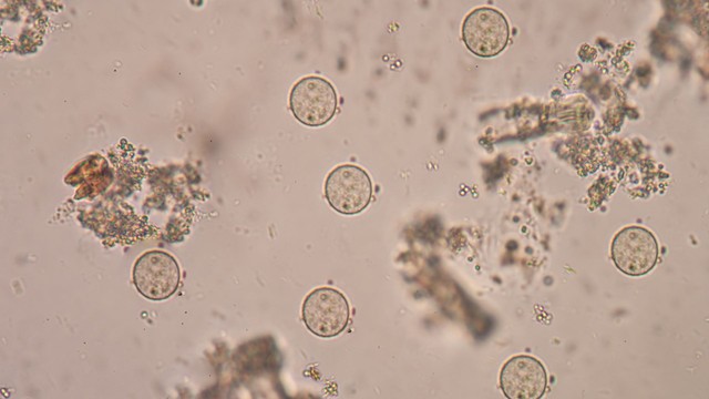 E. histolytica là gì? Nguyên nhân, triệu chứng và cách phòng ngừa hiệu quả