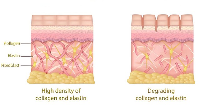 Elastin là gì? Vai trò của elastin đối với làn da