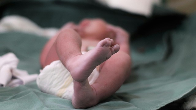 Giang mai bẩm sinh: Nguyên nhân, triệu chứng và cách phòng ngừa