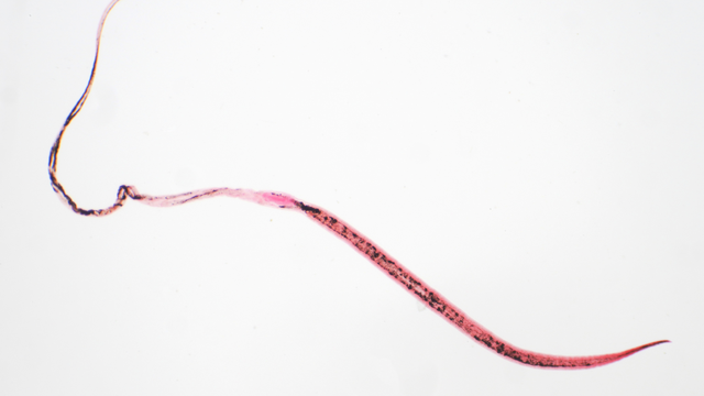 Giun tóc là gì? Đặc điểm, cách lây truyền, triệu chứng và cách phòng ngừa