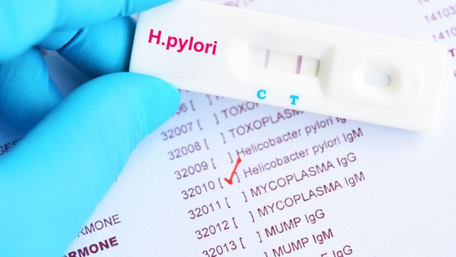 H.Pylori Ab là gì? Một số điều bạn cần biết về xét nghiệm H.Pylori Ab