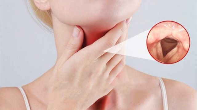 Hạt xơ dây thanh quản có nguy hiểm không​? Những điều bạn nên biết