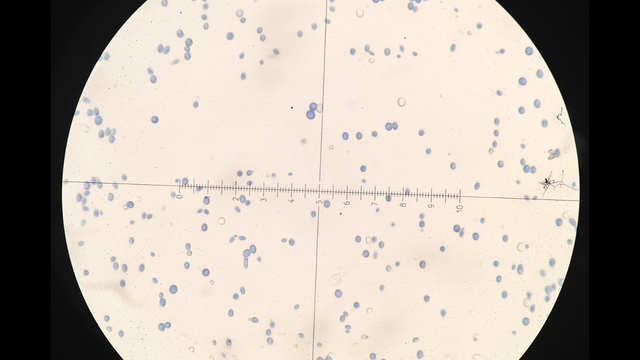 Hình ảnh nấm Candida soi tươi: Đặc trưng và cách nhận biết