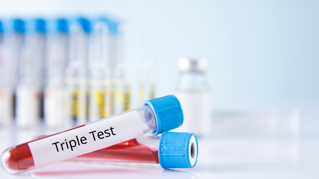 Kết quả xét nghiệm Triple Test: Cách đọc, ý nghĩa và hướng xử trí