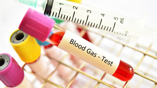 Khí máu động mạch: Xét nghiệm quan trọng giúp đánh giá chức năng hô hấp