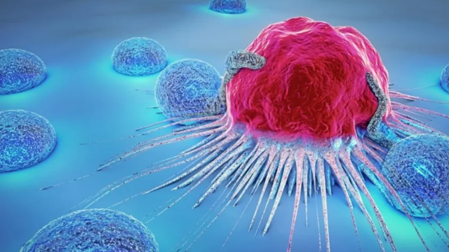 Khối u ác tính có chữa được không? Cách điều trị khối u ác tính