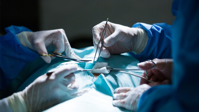 Khối u lành tính có nên mổ không? Hướng dẫn để quyết định đúng đắn