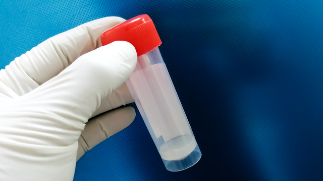 Kiểm tra tinh trùng bằng mắt thường và những điều cần biết 