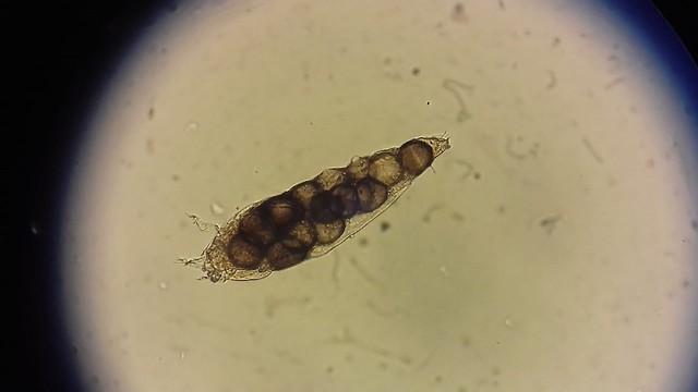 Ký sinh trùng Demodex là gì? Triệu chứng, nguy cơ và cách phòng ngừa hiệu quả