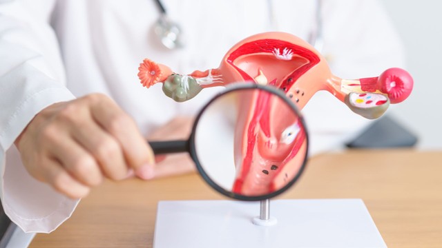 Loạn sản cổ tử cung: Triệu chứng, nguyên nhân và cách điều trị