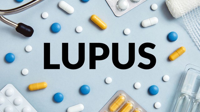Lupus ban đỏ có chữa được không? Phương pháp điều trị hiện nay