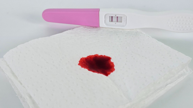 Máu báo thai có vón cục không? Những điều chị em cần biết