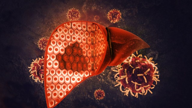 Máu nhiễm mỡ và gan nhiễm mỡ: Sự khác nhau, mối liên quan và cách phòng ngừa