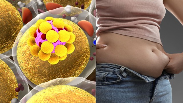 Mỡ nội tạng và mỡ dưới da khác nhau thế nào? Cách nhận biết và giảm mỡ hiệu quả