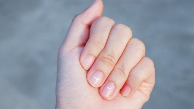 Móng tay trẻ có đốm trắng: Nguyên nhân và cách xử lý an toàn