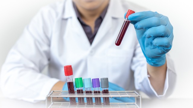 Một số nguyên nhân phổ biến gây Cyfra 21-1 dương tính giả