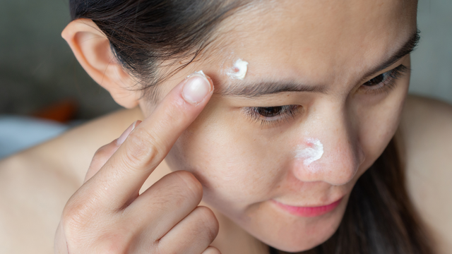 Mụn bọc sưng to​ phải làm sao? Cần lưu ý điều gì khi điều trị?