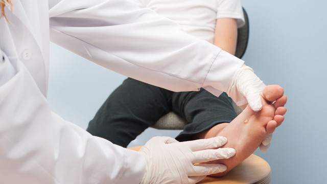 Mụn cóc ở trẻ em có khả năng lây lan không? Cách điều trị hiệu quả
