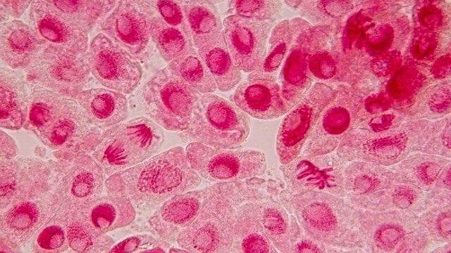 Myoglobin là gì? Xét nghiệm myoglobin và ý nghĩa lâm sàng
