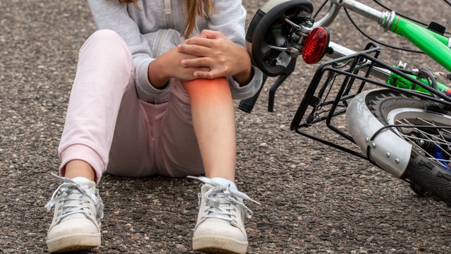 Ngã xe bị bầm tím: Cách xử lý đúng để hồi phục