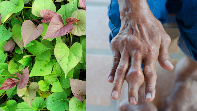 Người bị bệnh gút có ăn được rau lang không? Những thực phẩm cần tránh