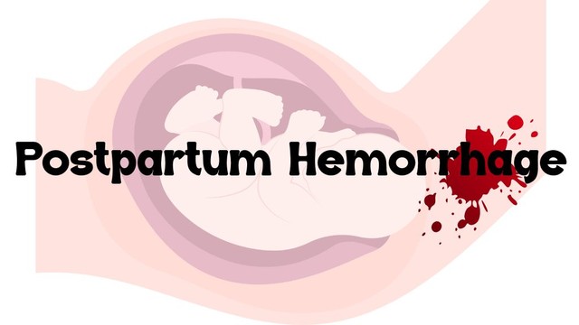 Nguyên nhân bị băng huyết sau sinh và những điều cần biết