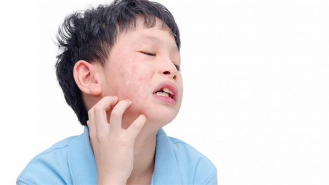 Sưng mang tai do nguyên nhân gì? Biện pháp phòng ngừa hiệu quả