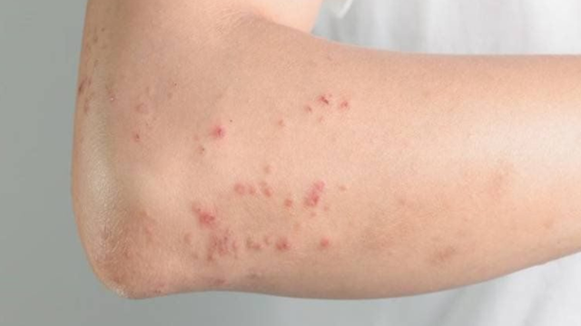 Nhận biết dấu hiệu bị nhiễm giun sán chó mèo