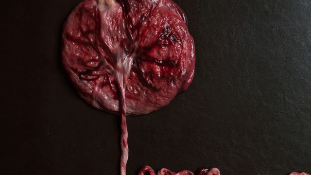 Nhau tiền đạo có nguy hiểm không? Biến chứng và lưu ý cần biết