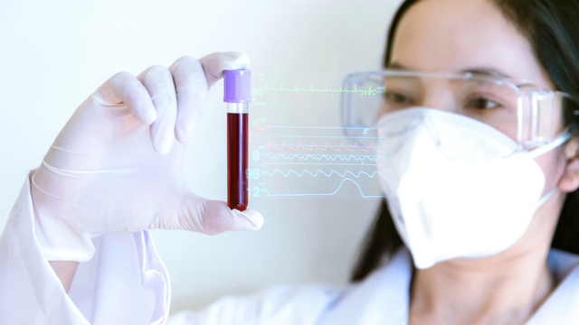 Nhóm máu hiếm nhất thế giới: Giải thích khoa học, phân loại và ý nghĩa trong y học