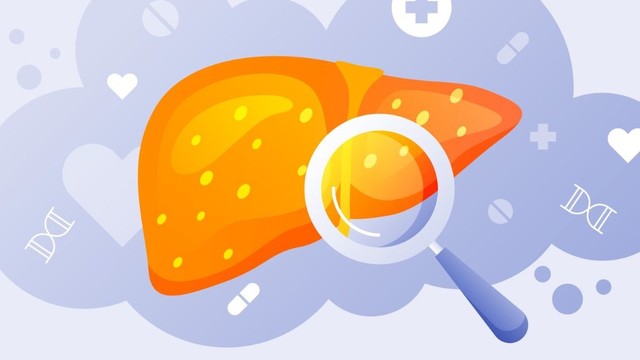 Dấu hiệu gan đang thải độc: Hiểu đúng và chăm sóc gan hiệu quả