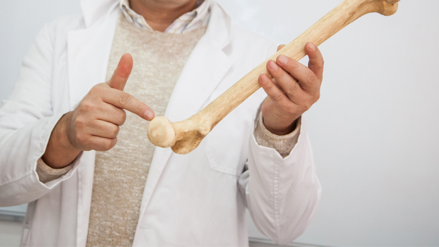Những loại trái cây tốt cho người bị gãy xương có thể bạn chưa biết!