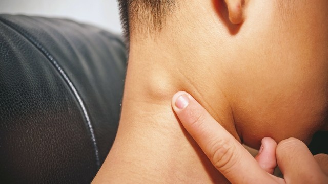 Nổi hạch ở cổ bên phải là dấu hiệu bệnh gì? Có nguy hiểm không?