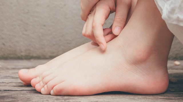 Nứt gón chân phải làm sao? Cách trị nứt gót chân tại nhà hiệu quả