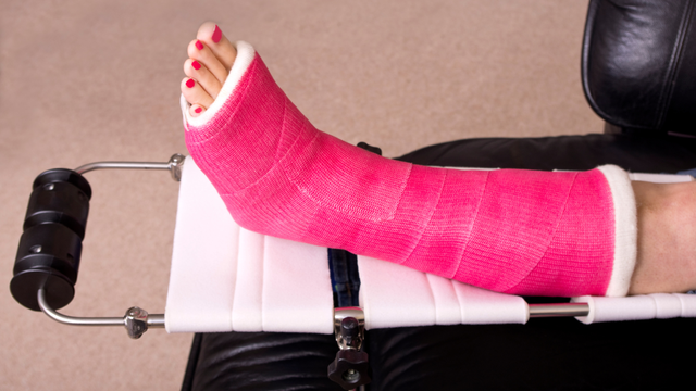 Nứt xương chân là gì? Phương pháp chẩn đoán và phòng ngừa