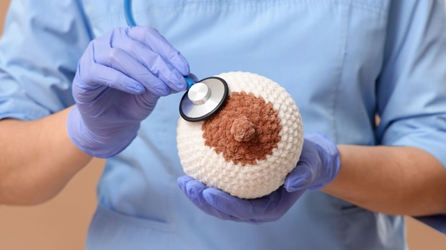 Paget vú: Nguyên nhân, triệu chứng, chẩn đoán và cách điều trị