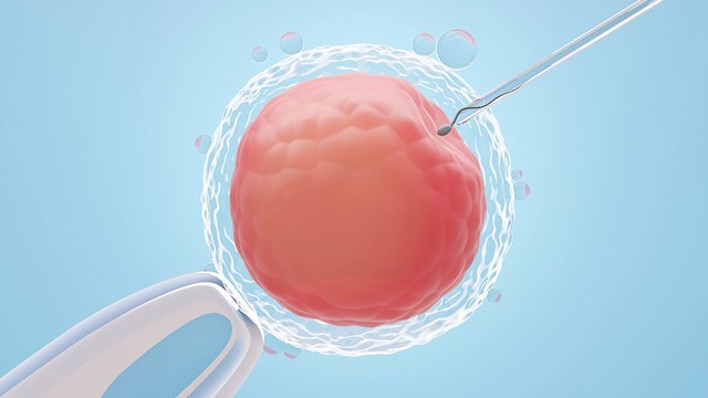 Quá trình làm IVF mất bao lâu? Tìm hiểu các giai đoạn thực hiện