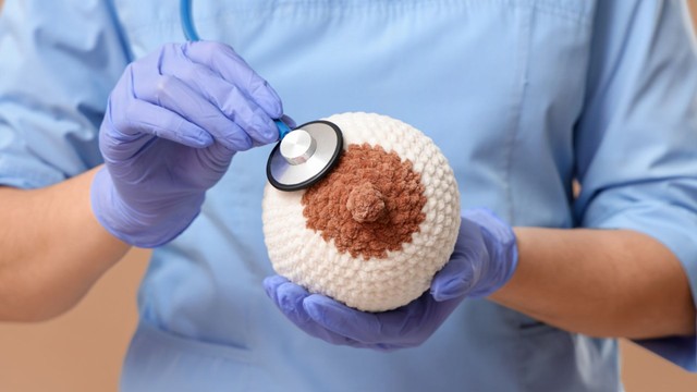 Quầng vú nổi hạt: Nguyên nhân, dấu hiệu và cách theo dõi