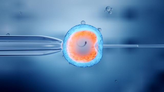 Quy trình làm IVF: Các bước thực hiện thụ tinh trong ống nghiệm