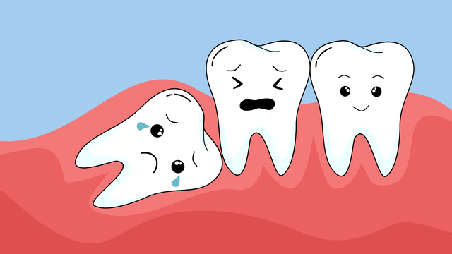 Răng khôn mọc ngầm là gì? Có nguy hiểm không và cần làm gì khi gặp phải