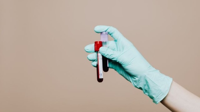 Sàng lọc phôi rồi có cần làm NIPT không? Giải đáp cho mẹ bầu