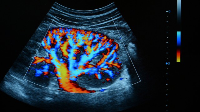 Siêu âm mạch máu: Phương pháp tầm soát tuần hoàn an toàn và cần thiết