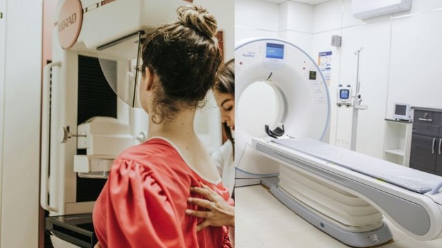 So sánh giá trị chụp nhũ ảnh và chụp MRI vú trong chẩn đoán ung thư vú