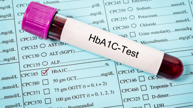 Sự khác nhau giữa glucose và HbA1c trong chẩn đoán tiểu đường