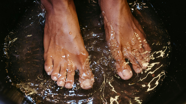 Suy giãn tĩnh mạch có ngâm chân được không? Hướng dẫn an toàn và cách chăm sóc đúng