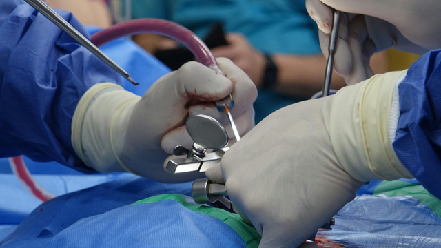 Tác dụng phụ của gây tê ngoài màng cứng sau sinh đối với mẹ bầu là gì?